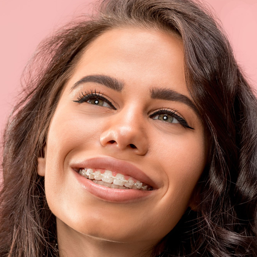 woman wearing clear ceramic braces