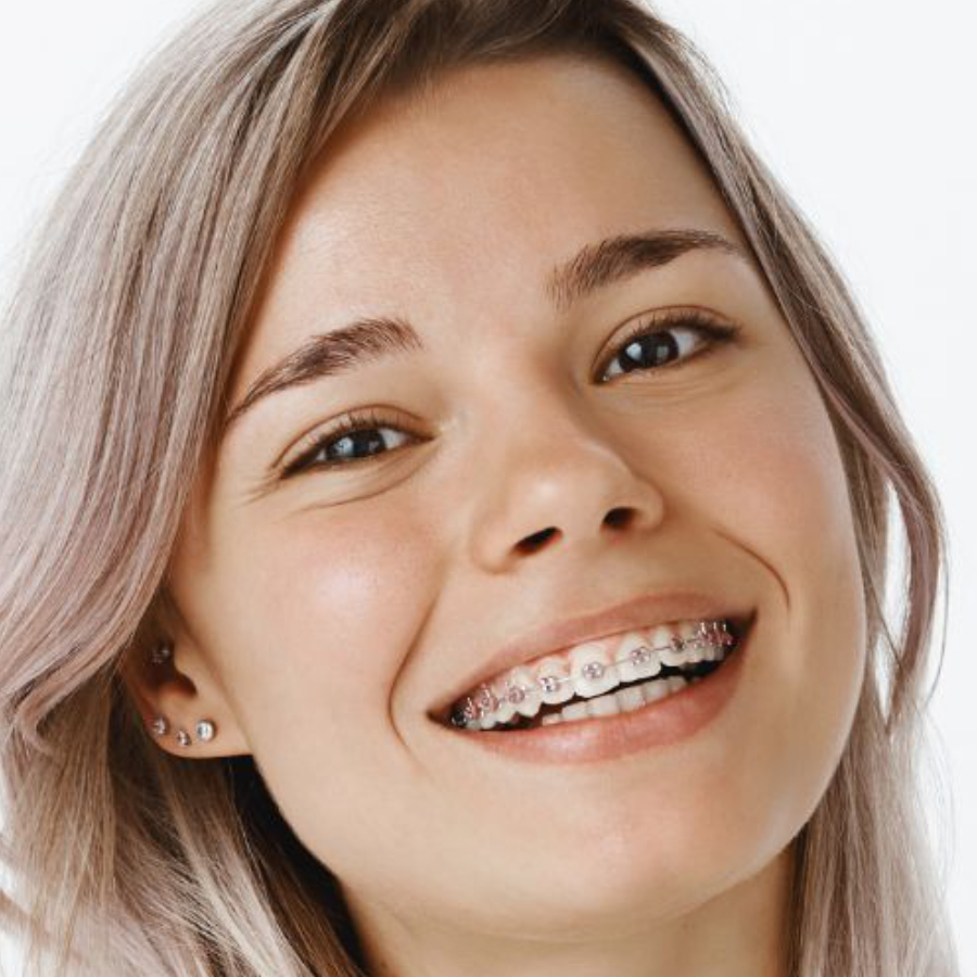 woman wearing traditional metal braces